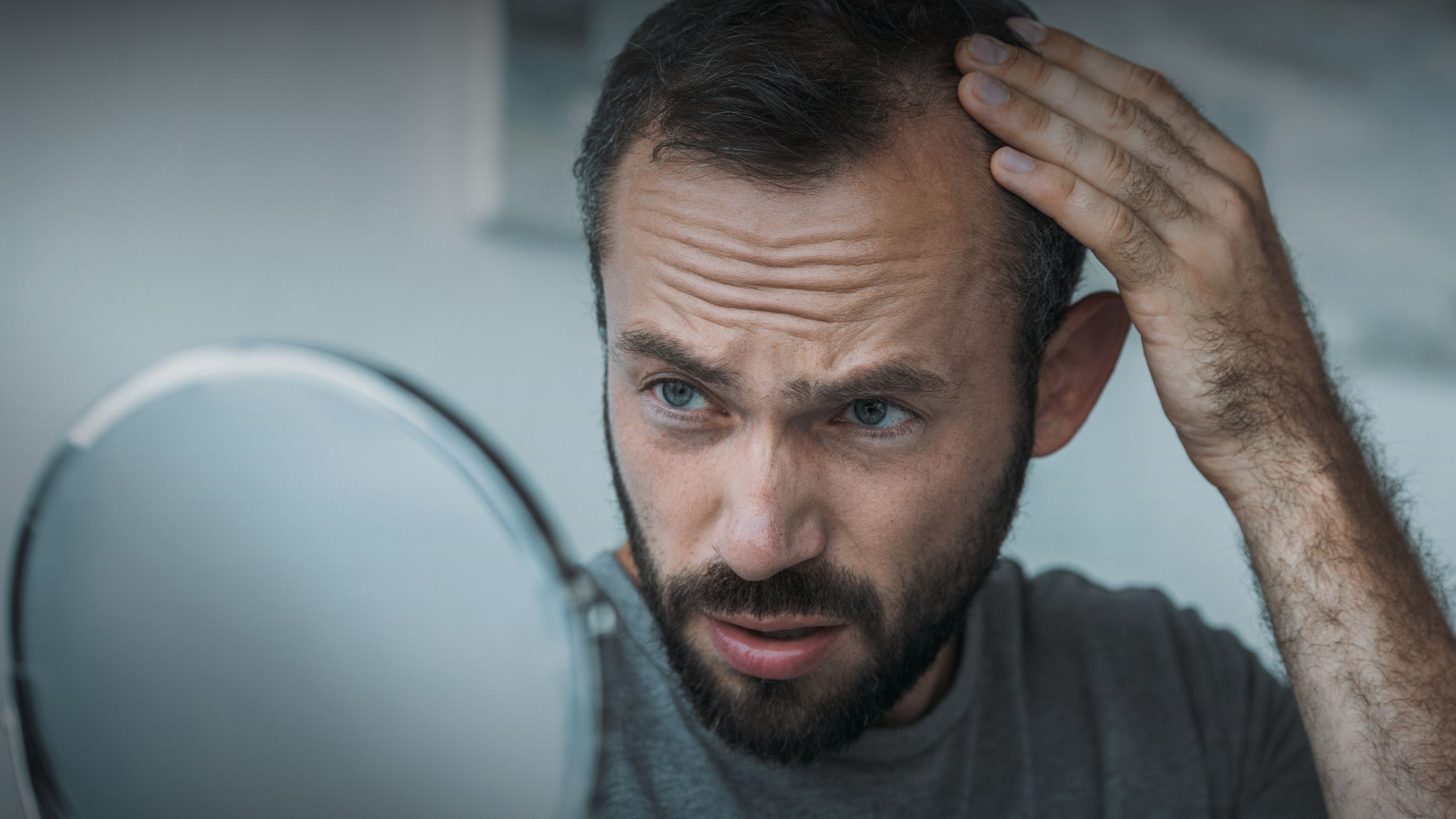 Descubra o que pode causar a queda de cabelo e como tratá-la com opções naturais, clínicas e, em casos avançados, com transplante capilar FUE.